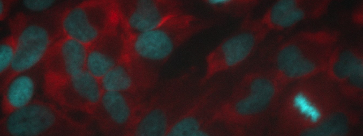 Mock Infected HeLa cells stained for DAPI and G3BP1