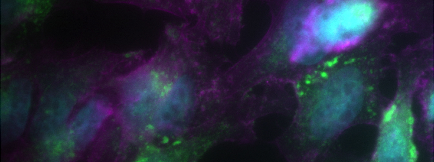 Vaccinia core localization (green) phalloidin-stained filamentous actin (purple).